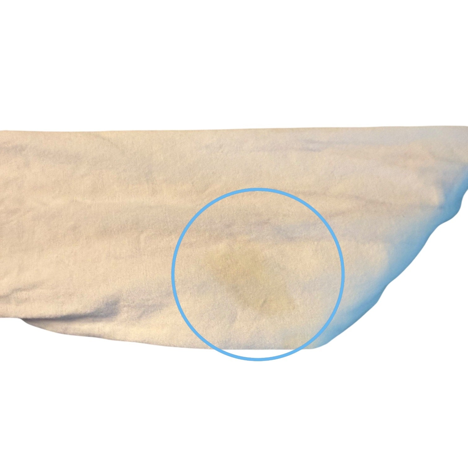 Close-up of issues on shirt with a blue circle highlighting a specific area.